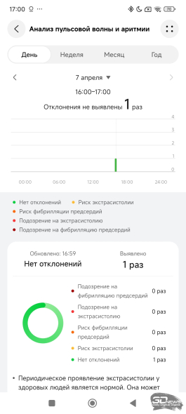 Фитнес-браслет HUAWEI Band 10: настоящий металл