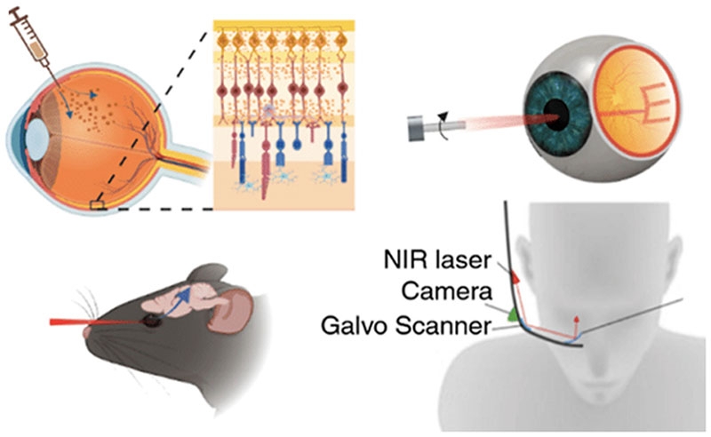 Учёные предложили буквально пускать золотую пыль в глаза для лечения возрастной слепоты