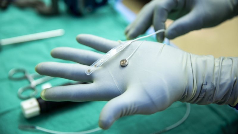 Мозговой имплант Connexus впервые подключили к человеку, но всего на 10 минут