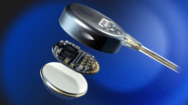 Мозговой имплант Connexus впервые подключили к человеку, но всего на 10 минут