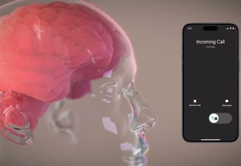 Neuralink намерен ежегодно устанавливать импланты в мозг 20 000 человек и получать не менее $1 млрд выручки