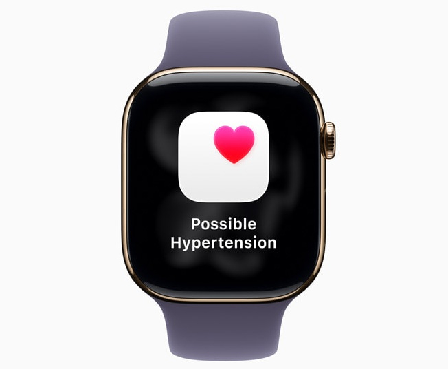 Apple выпустила watchOS 26: дизайн Liquid Glass, новые функции Apple Intelligence и мониторинг гипертонии