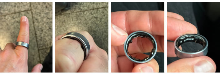 Раздувшаяся батарея Galaxy Ring сдавила палец и довела владельца до госпитализации