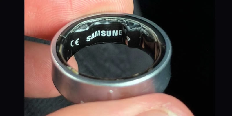 Раздувшаяся батарея Galaxy Ring сдавила палец и довела владельца до госпитализации