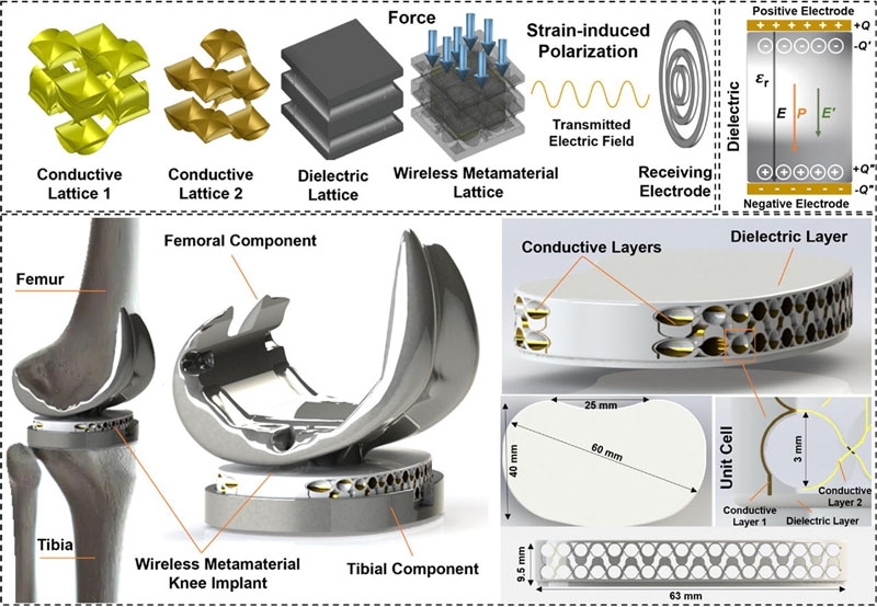 Инженеры-строители помогли создать первые в мире автономные датчики для лечения позвоночника