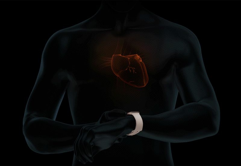 Получаемые с Apple Watch данные после обработки искусственным интеллектом позволяют диагностировать серьёзные болезни сердца