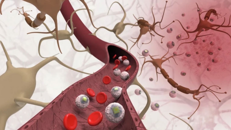 В MIT придумали чипирование без хирургии &mdash; имплант доберётся в мозг верхом на иммунных клетках