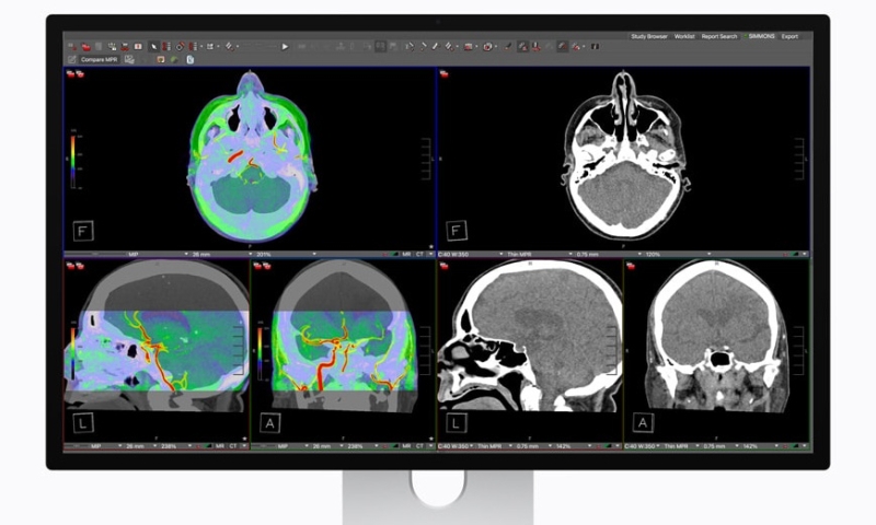 Apple представила новые мониторы Studio Display и Studio Display XDR по цене от $1599