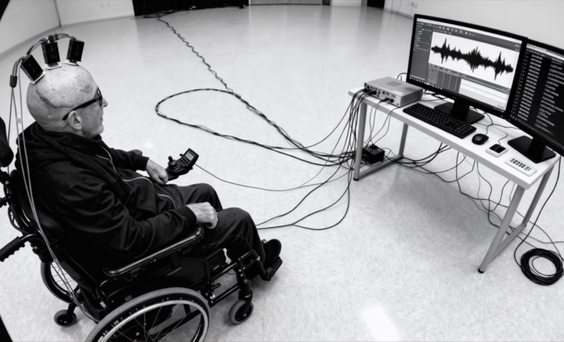 Киберпанк для панка: мозговые импланты позволили парализованному мужчине писать музыку